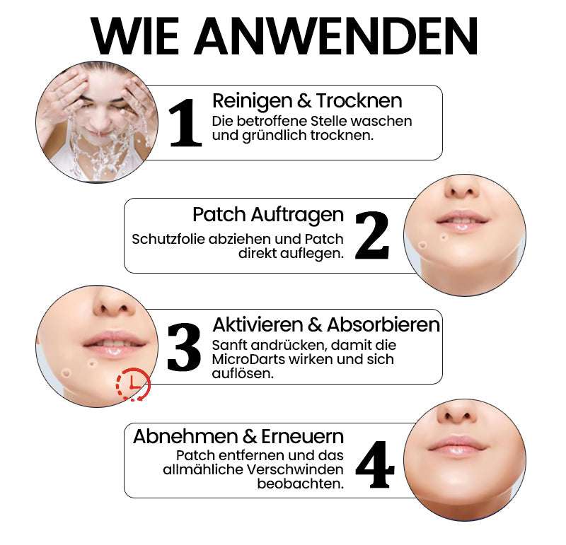 1+1 Gratis | DermiTag™ Pro MicroDarts TAG'Gone Hautpflaster zur Skin-Tag-Entfernung