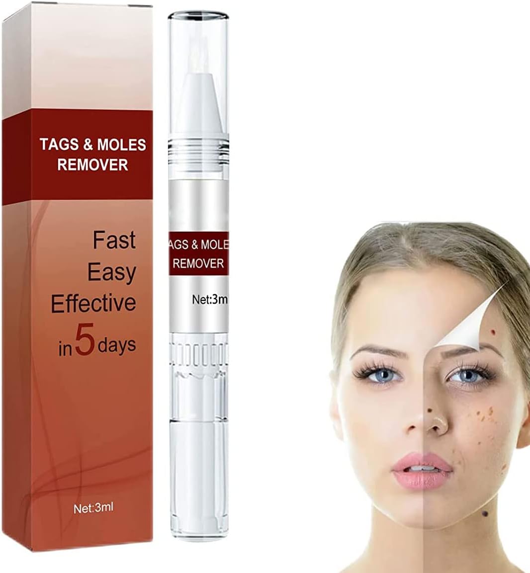 Hautflecken & Warzen Entferner | Schmerzfrei & Natürlich | Hautanhängsel Zuhause Entfernen | WartOff