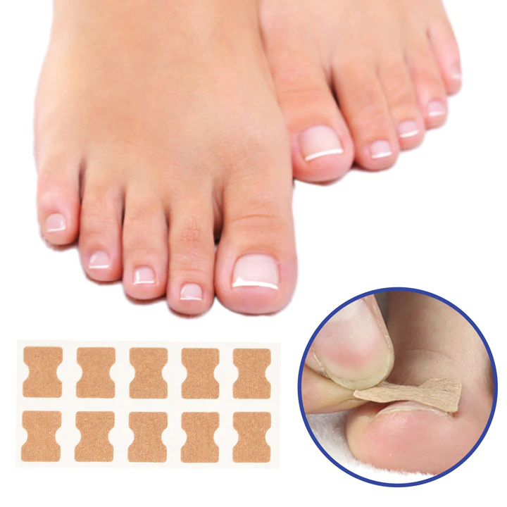 NailFixer™ Nagelkorrekturstreifen | Schmerzlinderung bei Eingewachsenen Nägeln | Dünn & Unauffällig | Medizinisches Pflaster