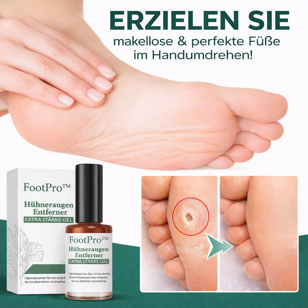 Hühneraugenentferner Gel | Extra Stark & Schmerzfrei | FootPro