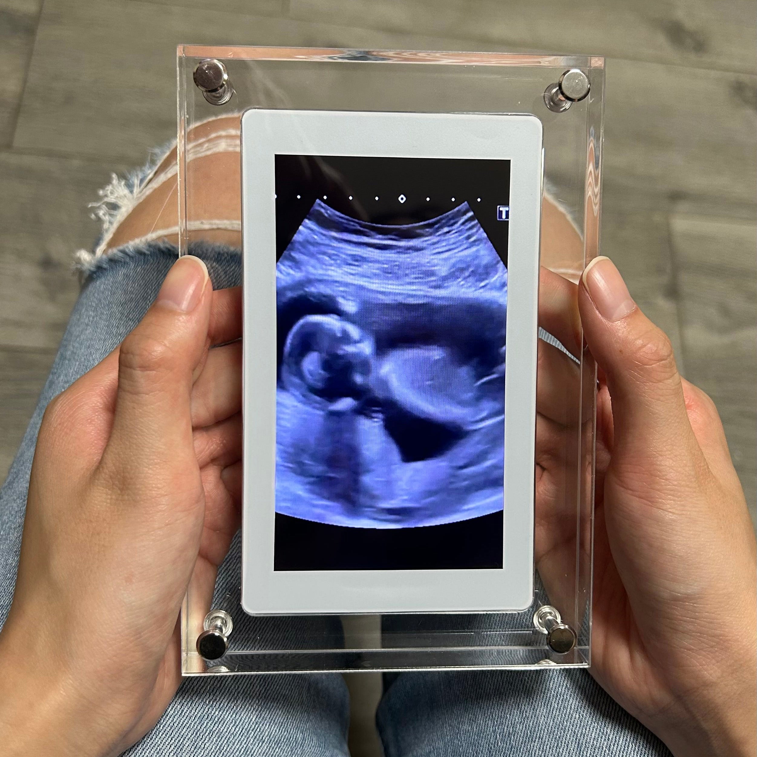 FrameIt™ - Lichtdigitale Bilderrahmen für unvergessliche Erinnerungen