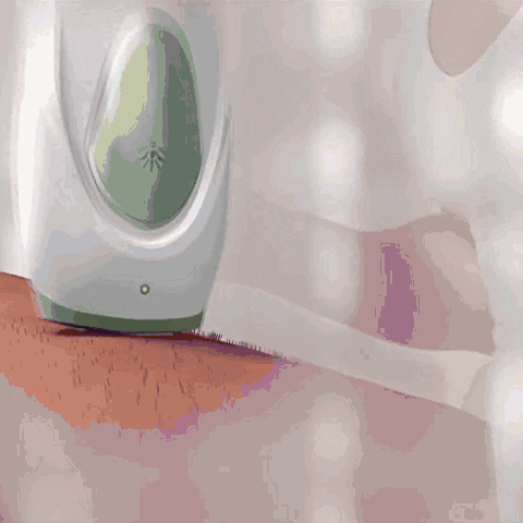 IPL Haarentferner | Schmerzlos | 5 Intensitätsstufen | Langzeit-Haarreduktion