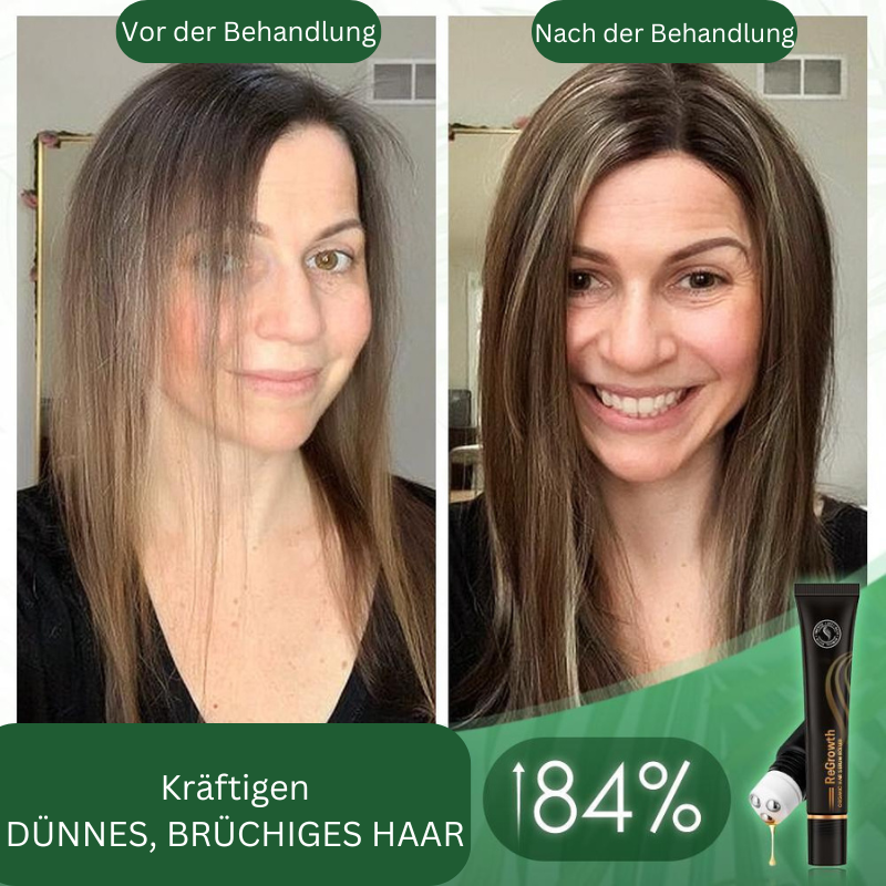 Regrowth™ Bio-Haar-Serum-Roller (1+1 gratis)