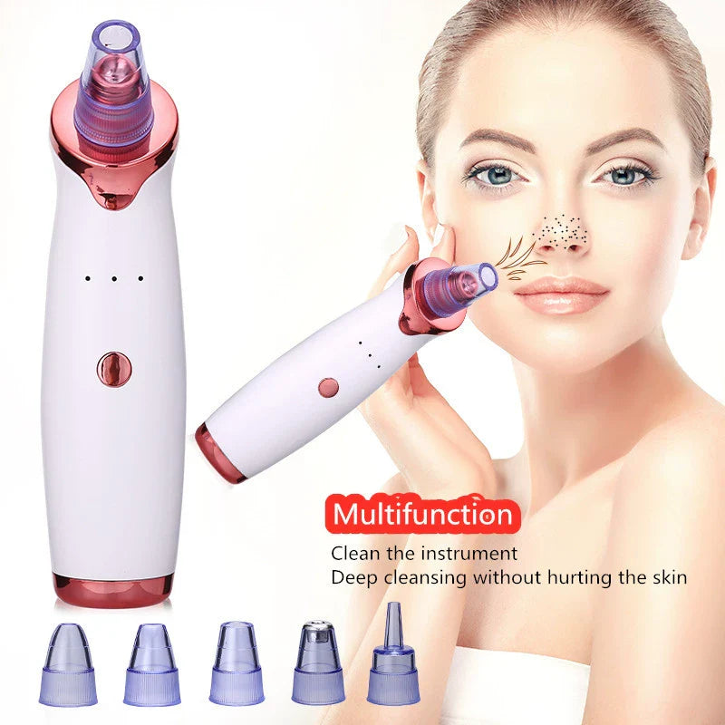 Porex™ - Elektrischer Mitesserentferner