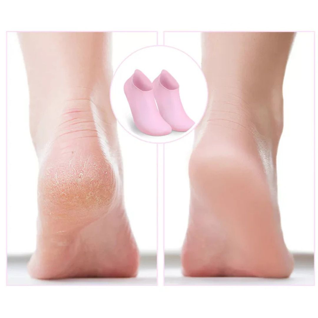1+1 Gratis | Silikiss™ Sie können weiche, glatte Füße bekommen, ohne teure Salonbesuche