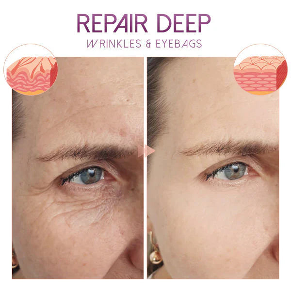 PrettyGlow™- Verjüngen Sie Ihre Augen!