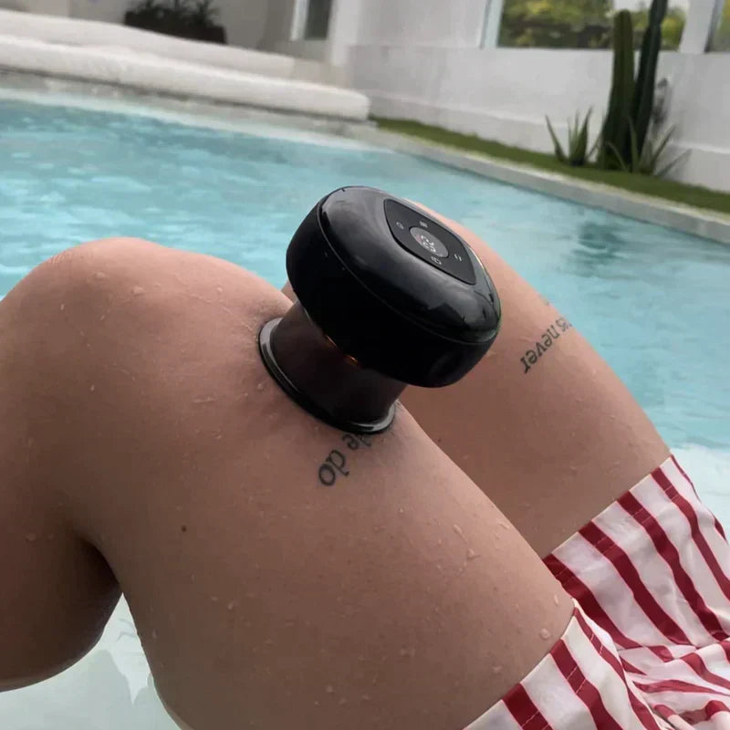 Cuppish™ Smart Cupping Massage Device