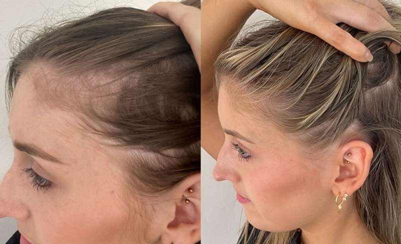 ReGrow™  | Sichtbare Ergebnisse in 7 Tagen