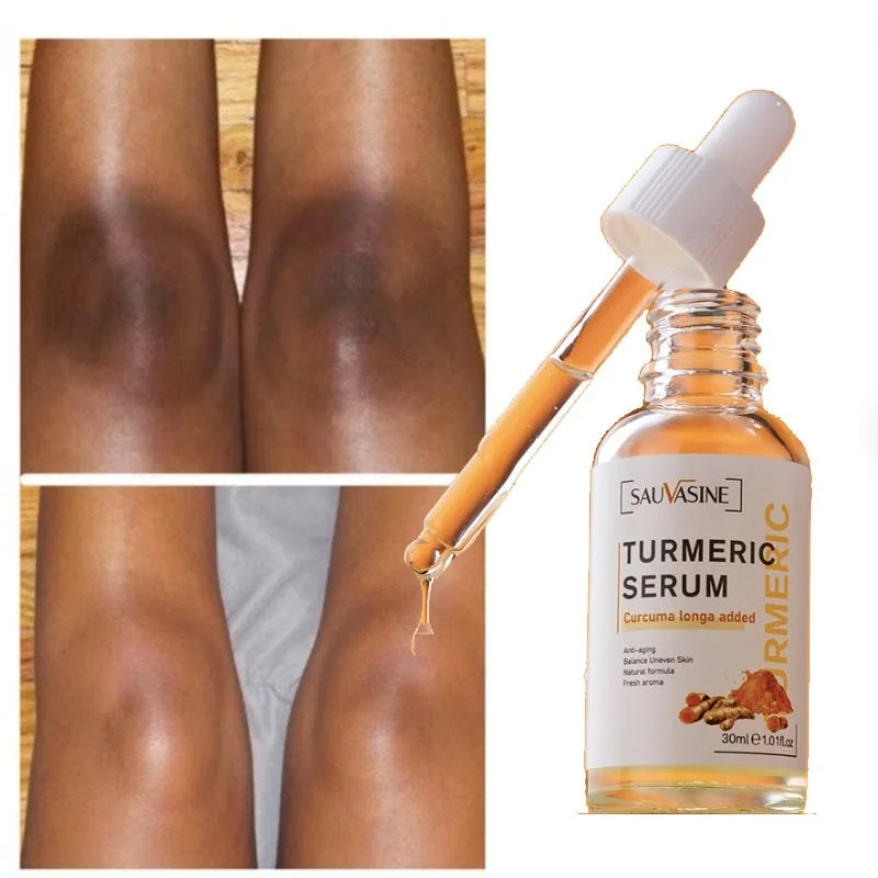 GoldenGlow™ - All-Natural Kurkuma Serum für dunkle Flecken und Akne Marks