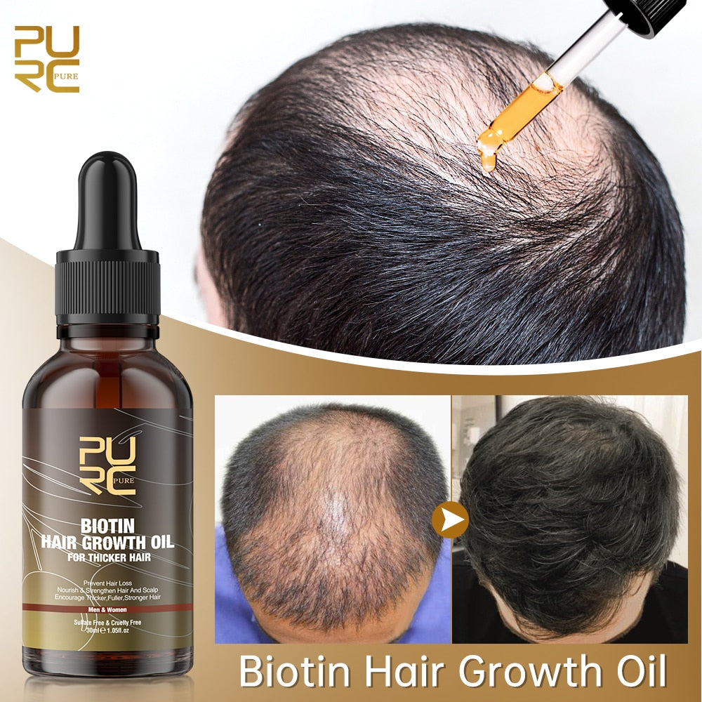 1+1 Gratis | BioPurc™ - Öl für Haarwachstum