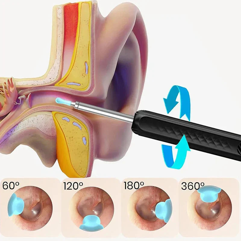 EarScan™ – Kabelloses Endoskop für Gesundheitsvorsorge & Ohrenreinigung