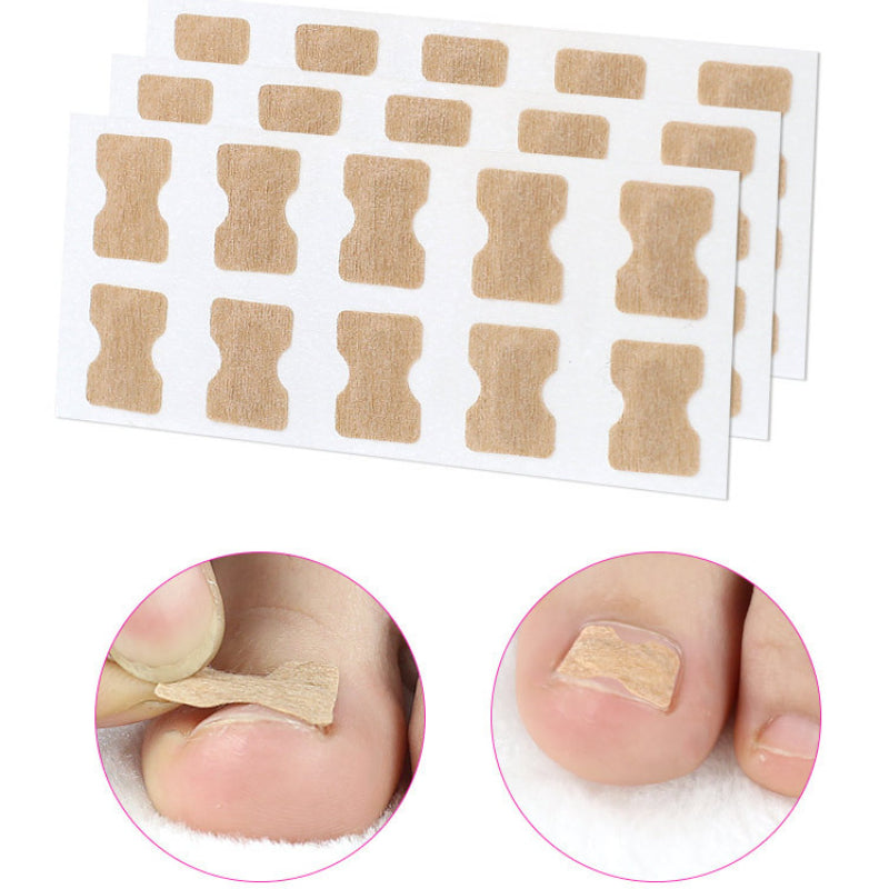 1+1 Gratis | EasyPatch™ - Eingewachsene Nägel und Nagelpilz entfernen