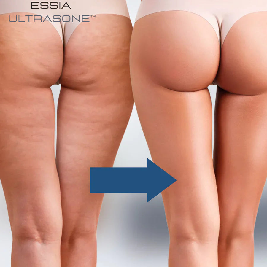 TonePro™- Straffen Sie Ihren Körper schnell!