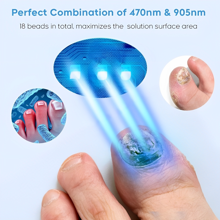 NailRenew™ | Nagelpilz bekämpfen und beseitigen!