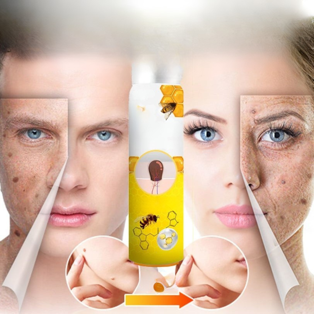 1+1 Gratis | Aqa™ - TagRecede Bienengift Behandlungs spray