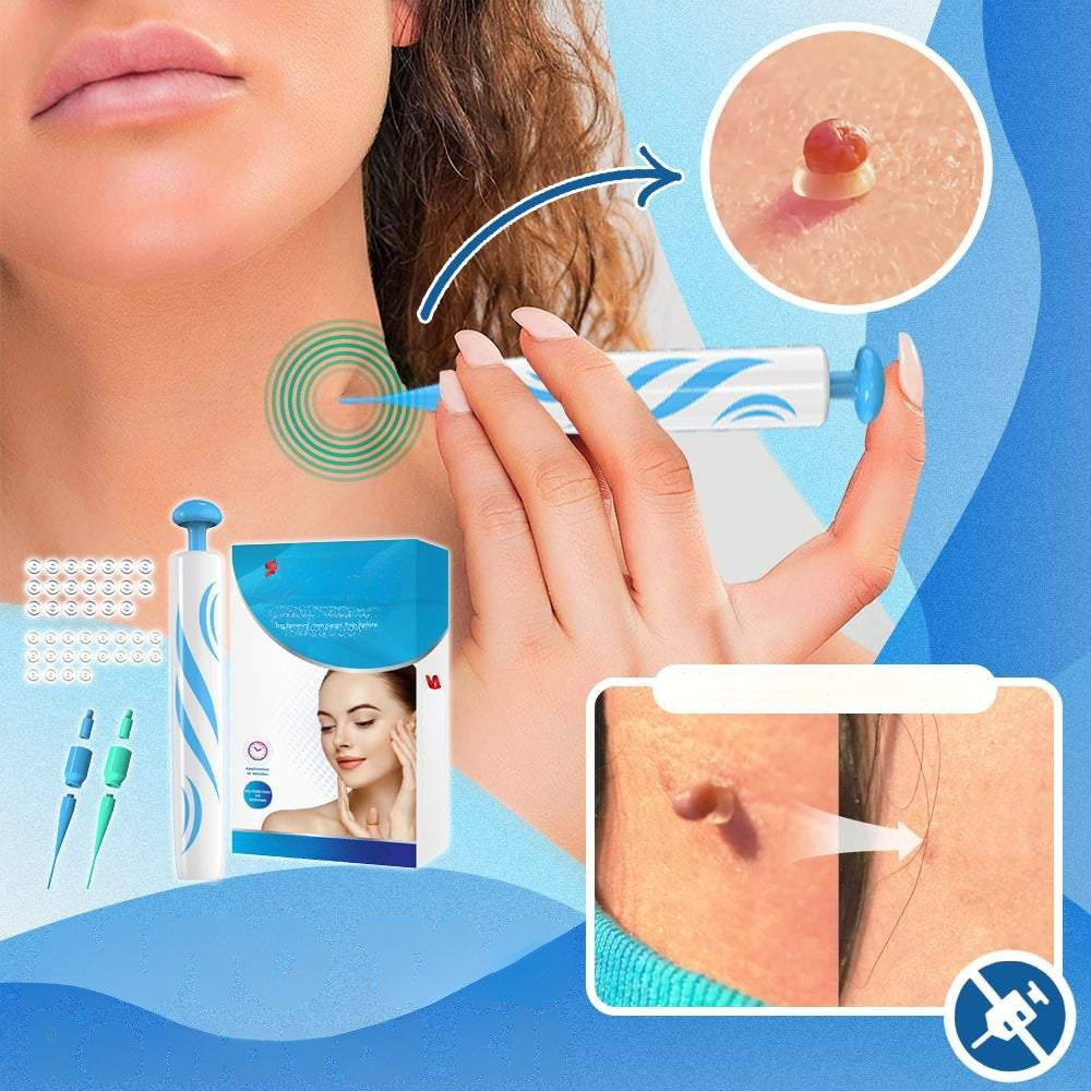 Warze verschwinden™ Kit zur Entfernung von Warzen
