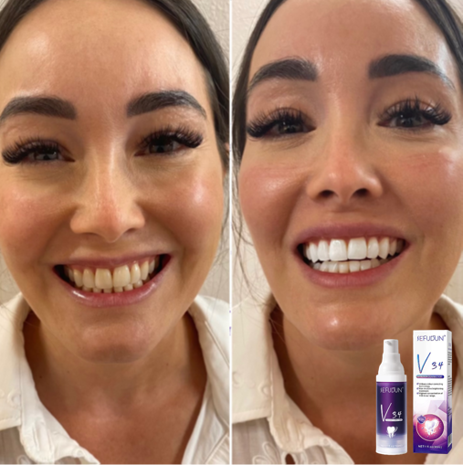 V34-CleanTeeth™- Farbkorrigierende Zahnpasta!