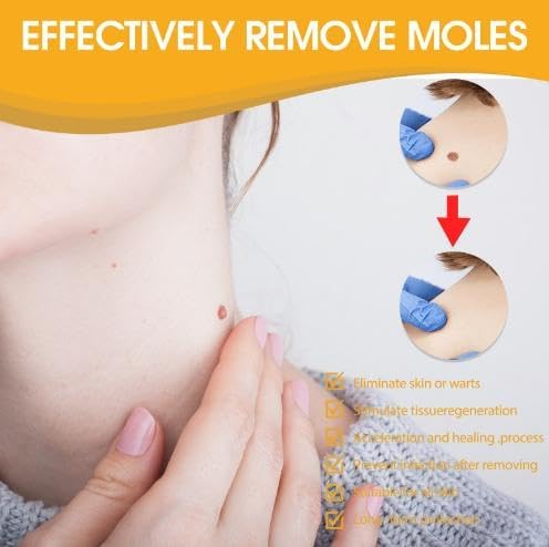 Warzen Entferner | Bienengift Formel | Effektiv & Schonend | TagAway | 1+1 Gratis