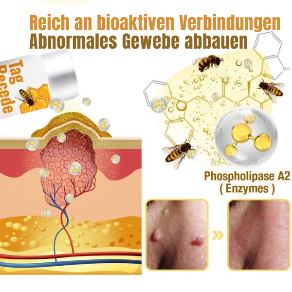 Warzen Spray | Bienengift Formel | Schmerzfrei