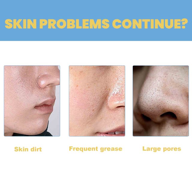 5+5 Gratis | DeepPurify™ Klärendes Serum — Löst Mitesser für Glatte, Strahlende Haut