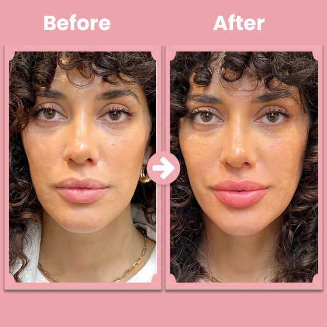 VoluFleur™ Lippenroller – Natürliche volle Lippen, die selbstbewusst strahlen, ganz ohne Schmerzen