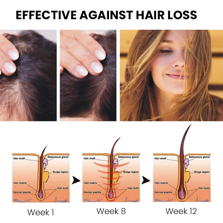 1+1 Gratis | SuperGrow™ - Haarwachstumsspray