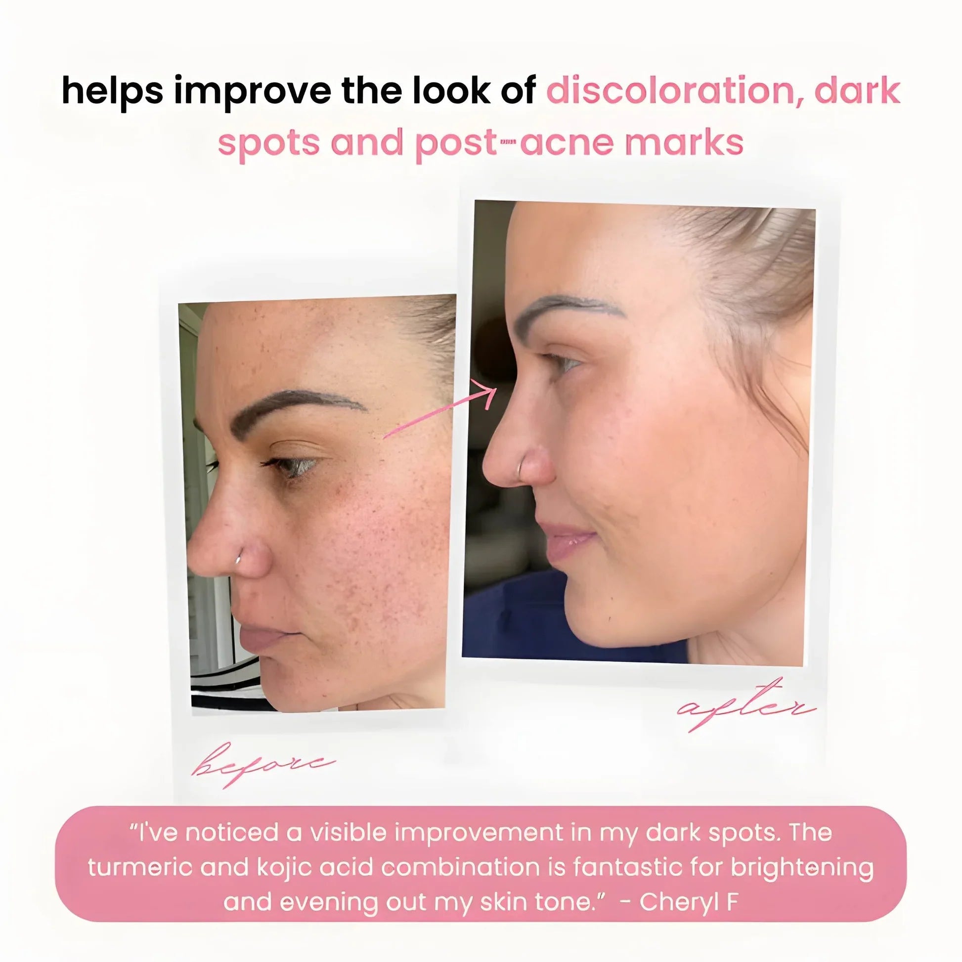2+2 GRATIS | BrightEase™ – Enthülle strahlende, gleichmäßige Haut, die Blicke auf sich zieht