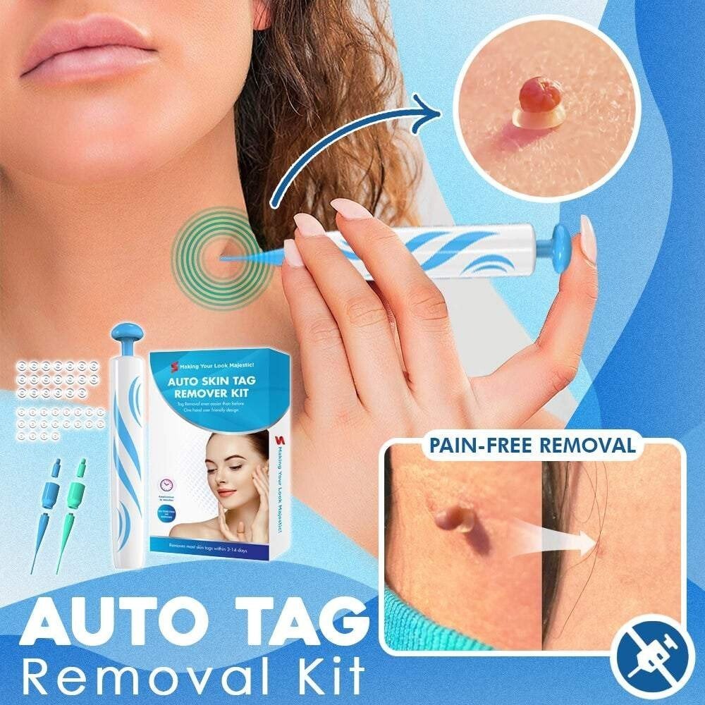 TagGone™ - Schnelles Auto-Tag-Entfernungskit