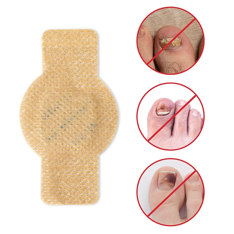 1+1 GRATIS | Nailox™ – Schnelle & diskrete Nagelpilz-Behandlung