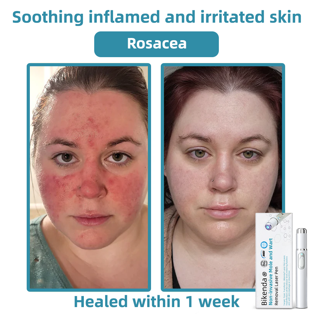 LumiDerm™ – Enthülle strahlende, makellose Haut und schnelles Selbstvertrauen