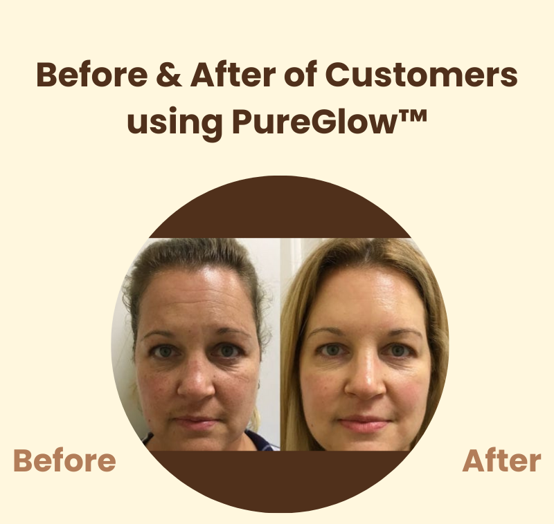PureGlow™ – Lösung für strahlende Haut
