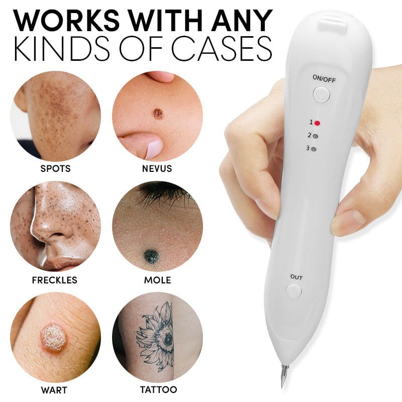 MoleOut™ - Spotfreier Elektrischer Beauty-Pen (50% RABATT)
