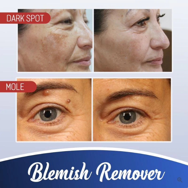 Miracle Cream™ - Erhalten Sie eine strahlende Haut