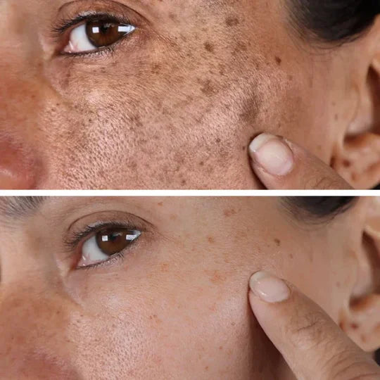 Luminate™ – Glow Serum zur Korrektur dunkler Flecken