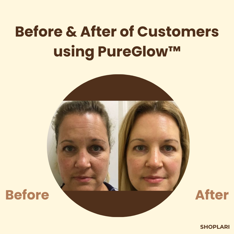 1+1 Gratis | PureGlow Schwarztee-Maske™ Reduziert Falten und feine Linien für jugendliche Haut