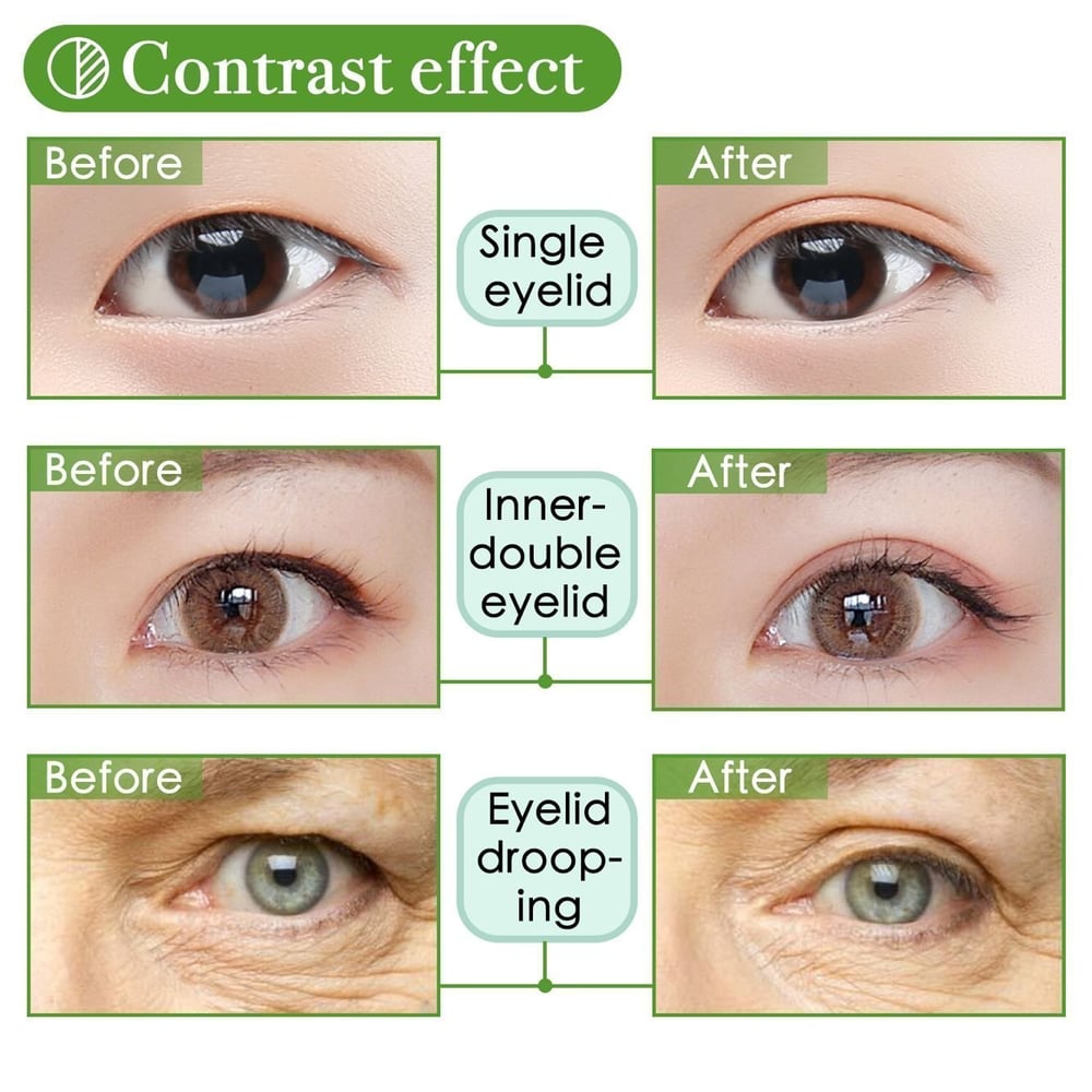 VivaLift™ – Sofortiges Anheben hängender Augen für einen jugendlichen, lebendigen Look
