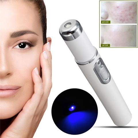 Laser Therapy Aknegerät | Blaulichttherapie | Tragbar & Chemiefrei | 4-in-1 Hautpflege