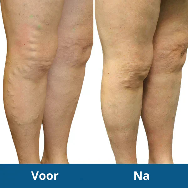 Mooje FootPulse™ | Behandel pijnklachten en stimuleer vetverbranding!