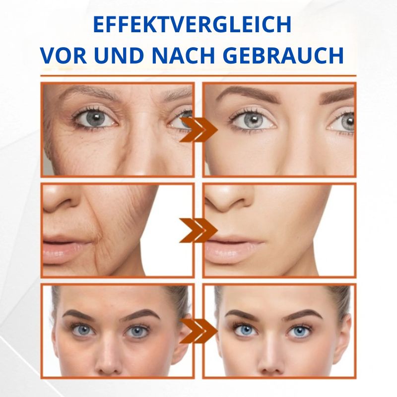 1 + 2 GRATIS | Eterna-glow™ Lösliches Kollagen