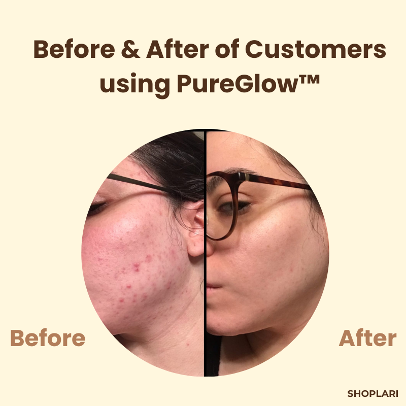 1+1 Gratis | PureGlow Schwarztee-Maske™ Reduziert Falten und feine Linien für jugendliche Haut