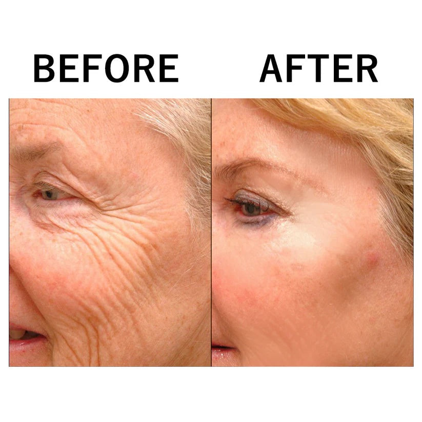 1 + 1 GRATIS HEUTE | HydraLift™