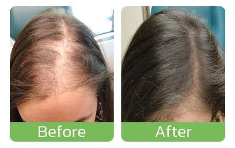 GrowthPlus™ - Nährendes Ingwer-Spray
