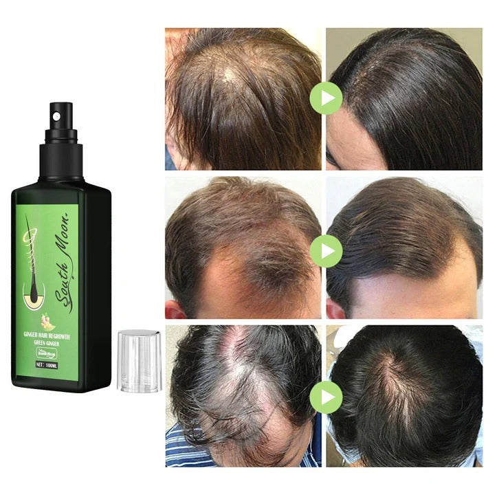 GrowthPlus™ - Nährendes Ingwer-Spray