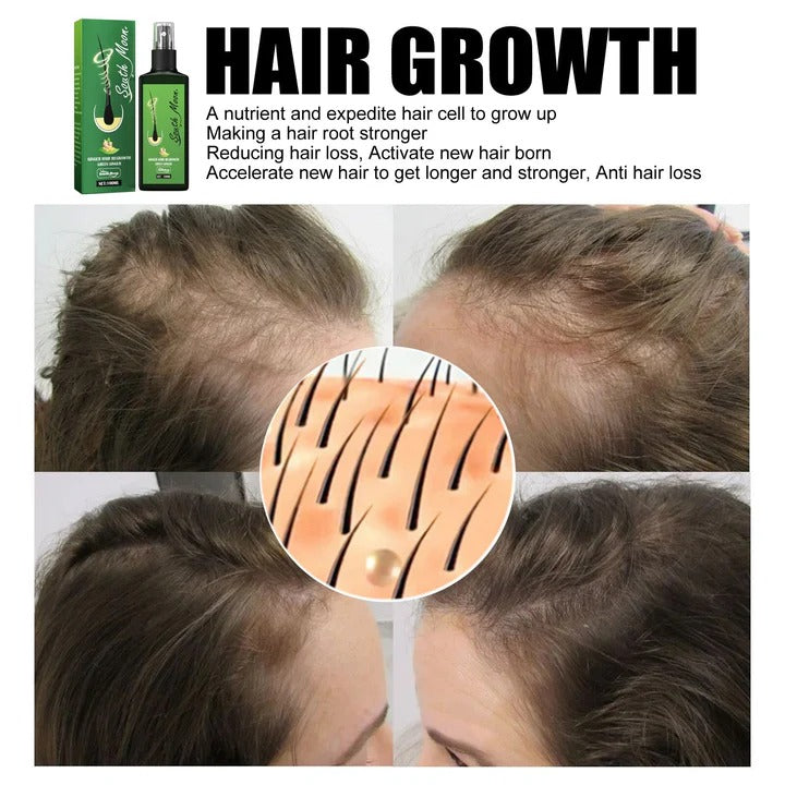 GrowthPlus™ - Nährendes Ingwer-Spray