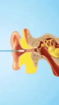 Earvana™ - Intelligenter Ohrreiniger mit Kamera