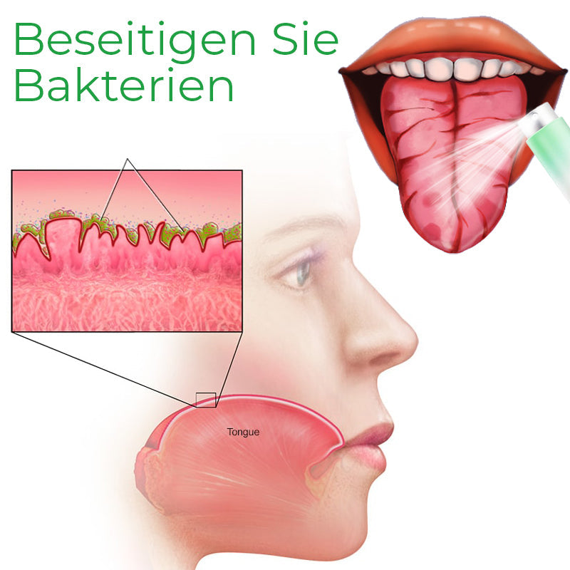 Zungenspray Gegen Rissige Zunge