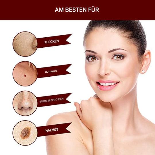 1+1 Gratis | WartOff™ Einfache Entfernung Von Hautflecken Und Muttermalen