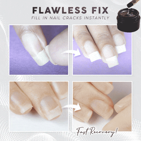PrettyGel™- Reparieren Sie Ihre Nägel ganz einfach!