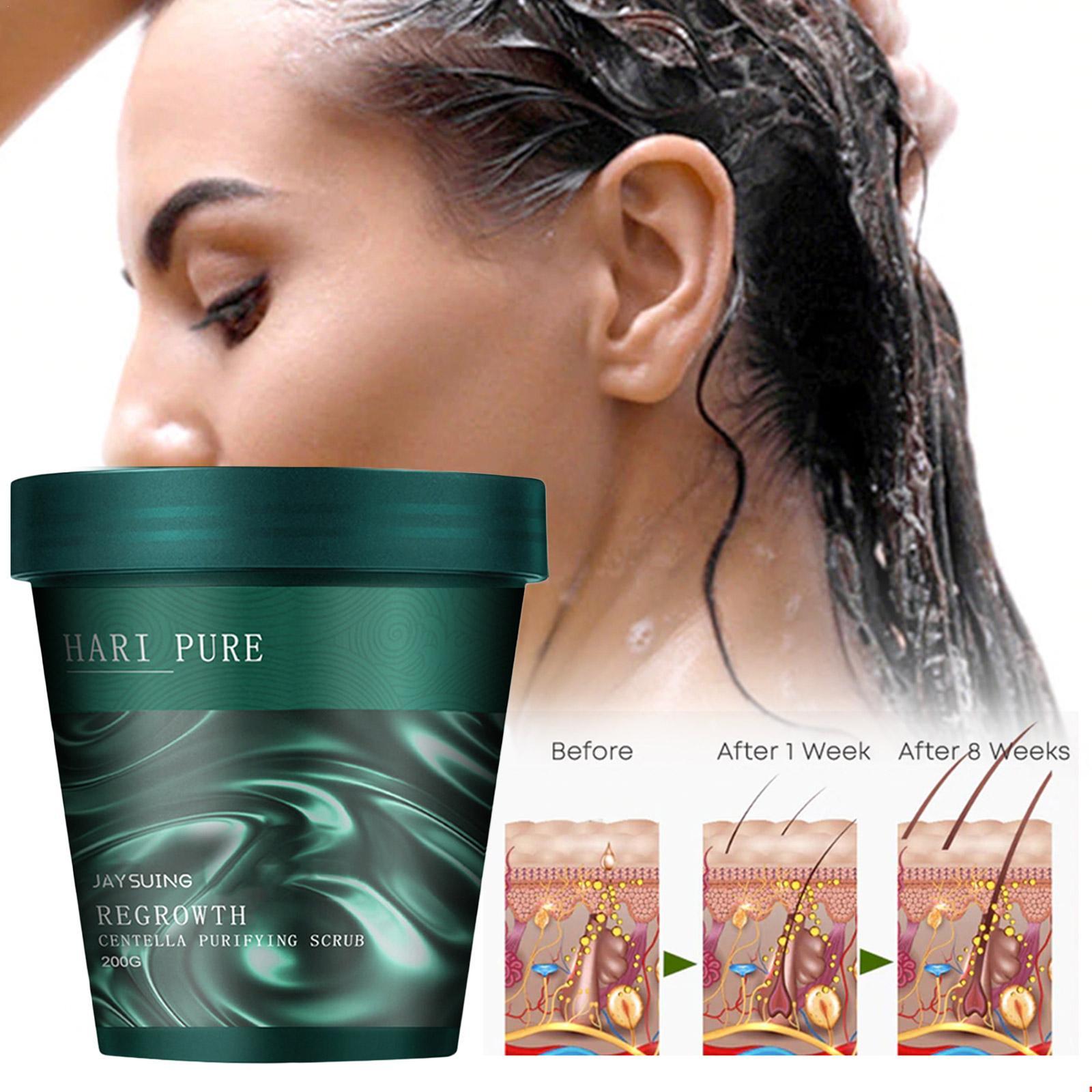 1+1 Gratis | Haar Peeling | Gegen Haarausfall | Fördert Dichtes Haar | Mit Centella Extrakt | HairPure™