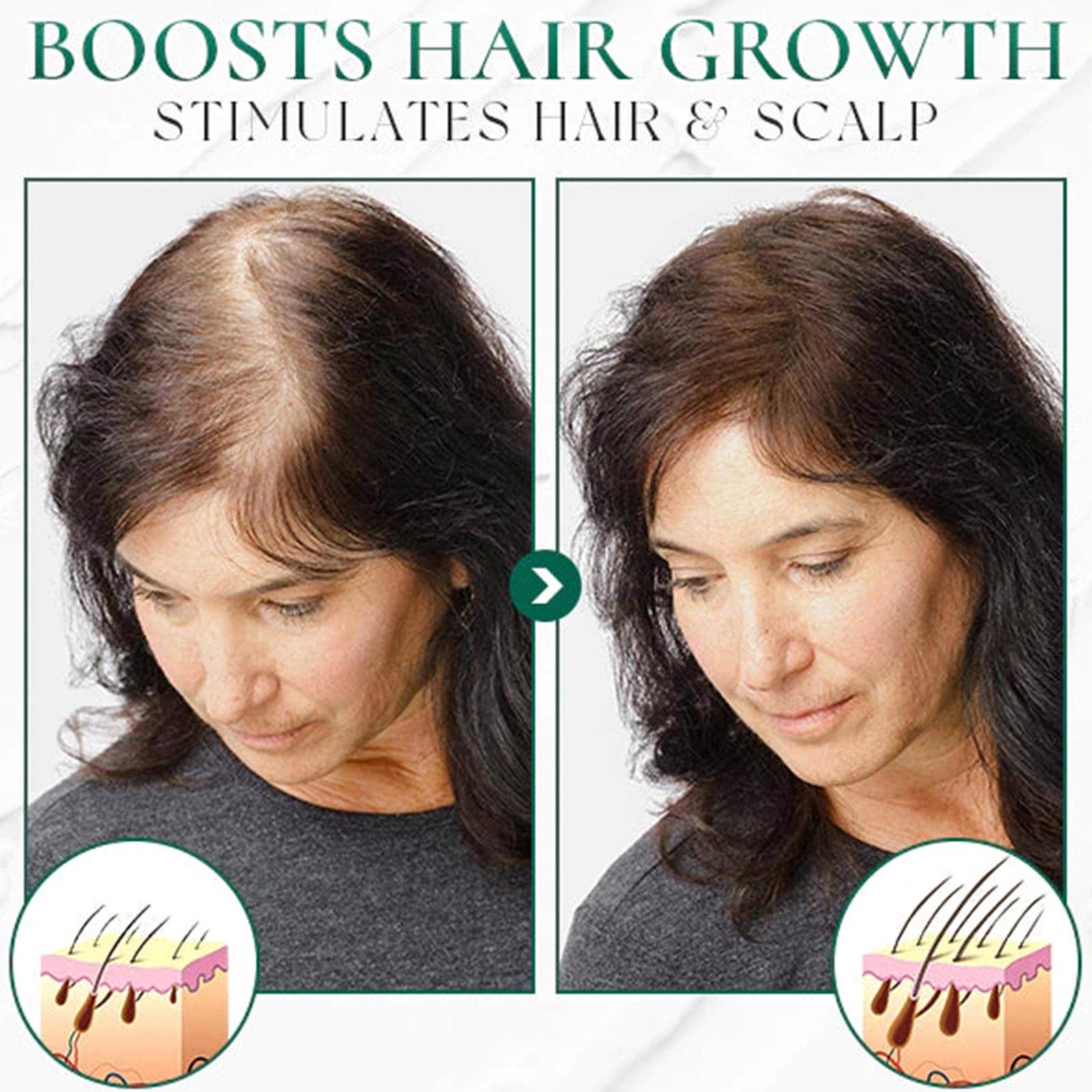1+1 Gratis | HairPure™ Peeling für das Nachwachsen der Haare